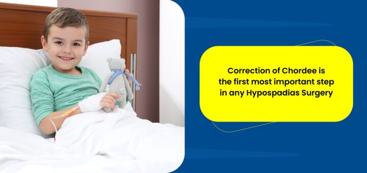 Correction of Chordee is the first most important step in any Hypospadias Surgery