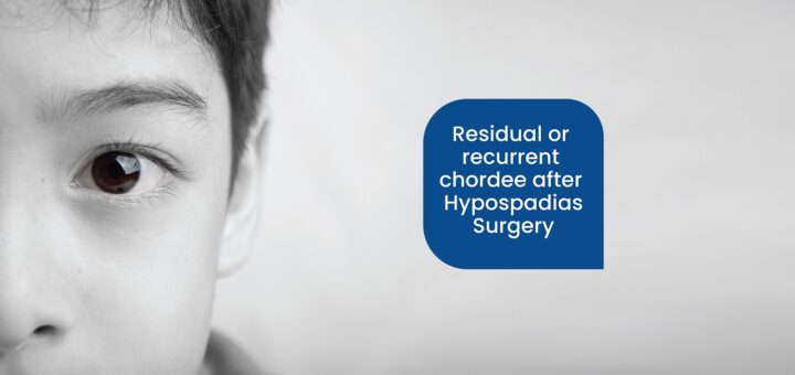 Residual or recurrent chordee after Hypospadias Surgery