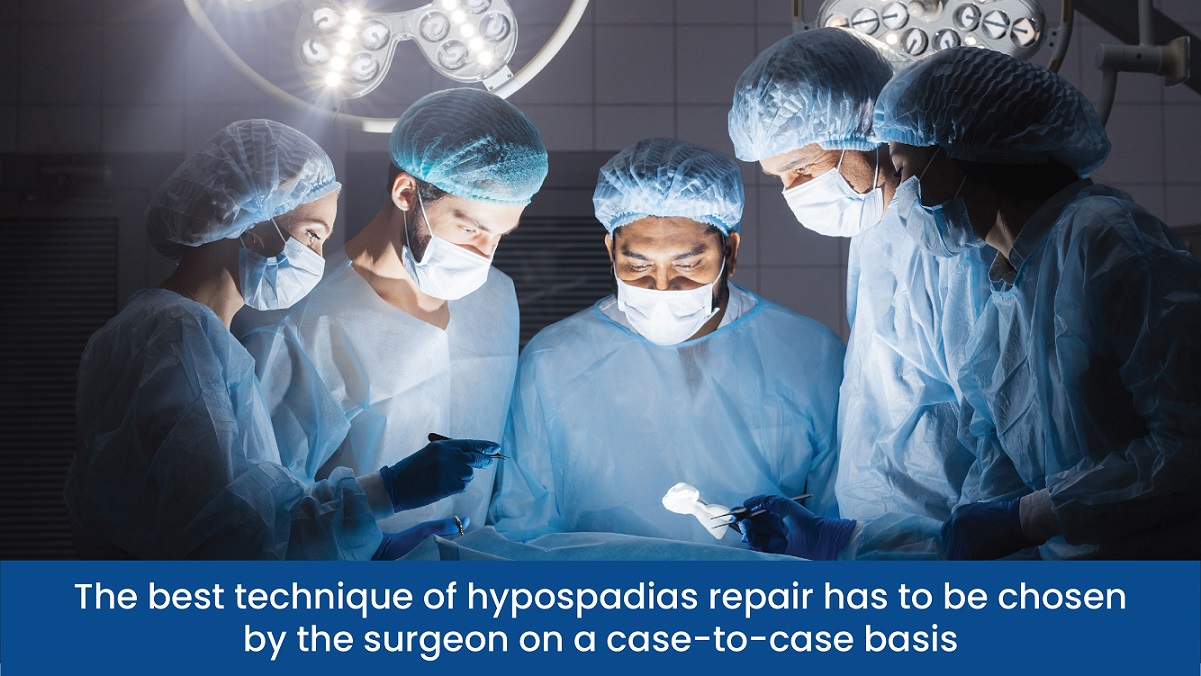 The best technique of hypospadias repair